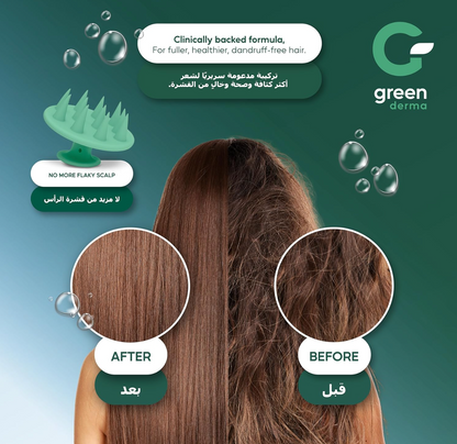 Green Derma Shower Filter — Chrome